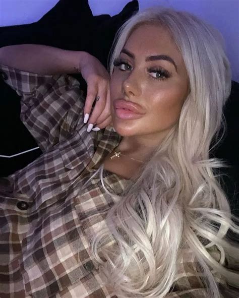 chloe ferry lips|is chloe ferry still alive.